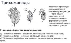 Контроль на трихомонады