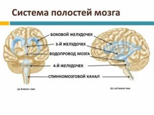 3й желудочек мозга меньше нормы