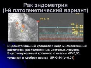 ЖТ с единичными локусами периферического кровотока