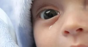 Слезится один глаз у ребёнка