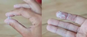 Могут ли быть после вагинальных свечей белые выделения?
