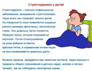 Стрептодермия повторяется снова и снова, причины