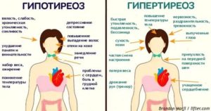 Температура при тиреотоксикозе