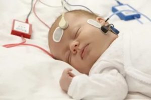 Резкая потеря слуха у ребёнка