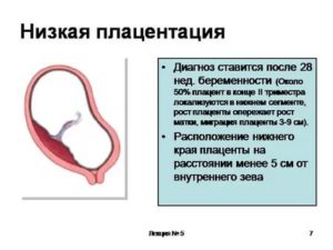 Может ли плацента опуститься