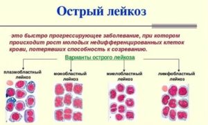 Орви или лейкоз