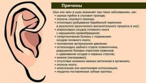 Шум пульсация в ухе при повороте головы