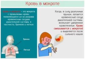 Сухой кашель и кровь в слюне