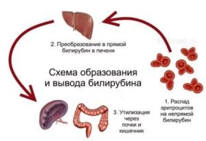 Повышенный билирубин и операция