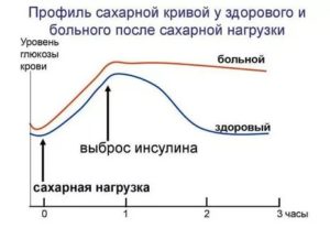 Сахарная кривая в беременность