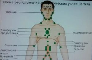 Лимфоузел справа у мужчины. Схема расположения лимфатических узлов на теле. Лимфатический узел человека. Парааортальные лимфоузлы.