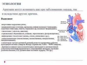 Аритмия сердца, антитела к проводящей системе сердца