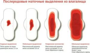 Резкое прекрашение месячных