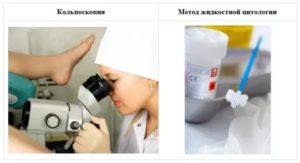 Цитология, кольпоскопия