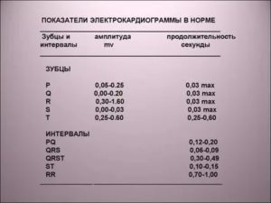 Показатели ЭКГ сердца годовалого ребенка