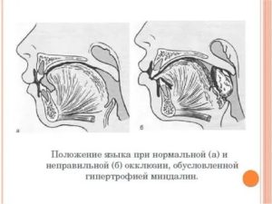 Положение языка во рту