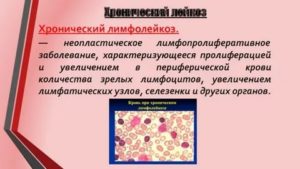 Увеличенные лимфоузлы и лимфоциты