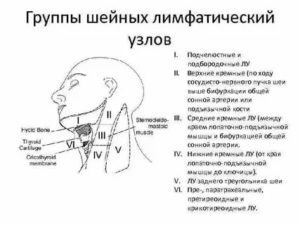 Увеличены все группы лимфоузлов