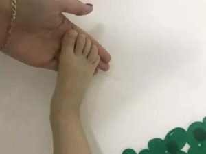 Опухший пальчик на ноге у ребенка
