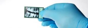 Анестезия и рентген зуба до задержки