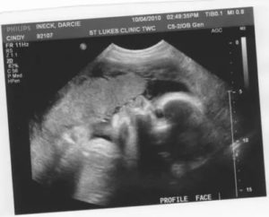 Вес плода на 31-32 недели