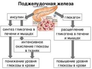 Может ли быть повышеный сахар при отсутствии панкреатита?