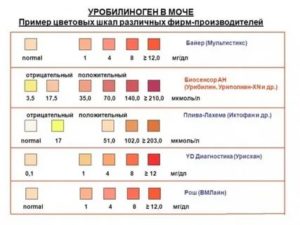 Уробилиноген в моче ребенка