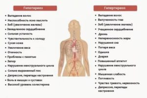 Температура при тиреотоксикозе