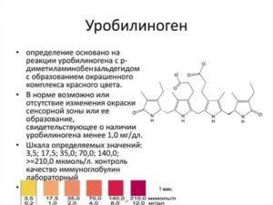 Уробилиноген в моче ребенка