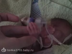 Отошли воды в 22 недели или просто недержание?