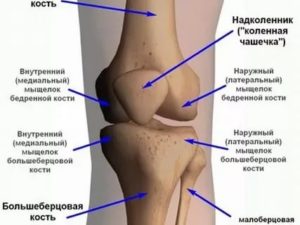 Травма колена, контузионные изменения бедренной кости