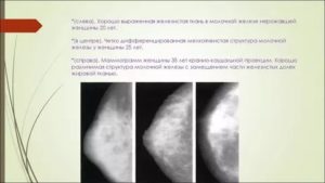 Преобладание железистой ткани