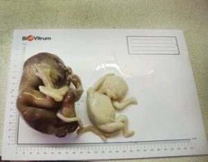 Погибают эмбрионы