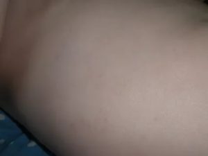 Сыпь у ребенка чуть ниже груди