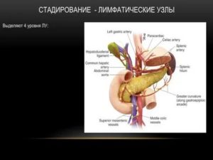 Лимфоузел в гепатодуоденальной связке