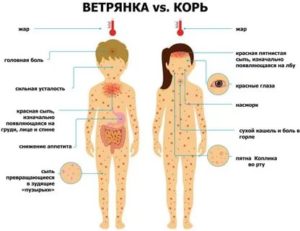 Сыпь после ветрянки