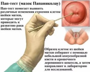 Можно ли узнать когда моя дочка лишина девственности?