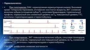 Тахикардия из за гипотиреоза