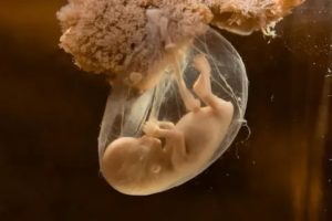 Погибают эмбрионы