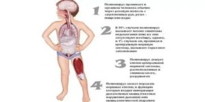 Ревакцинация полиомиелита после болезни