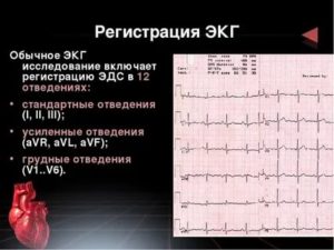 Срок годности ЭКГ с нагрузкой