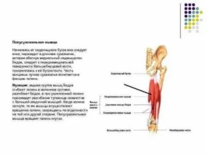 Отрыв сухожилия длинной головки двуглавой мышцы бедра от седалищного бугра