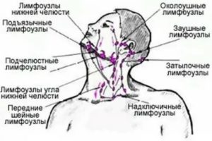 Лимфоузел в углу челюсти 2.4 см