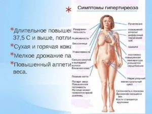 Резкие скачки давления, гипотиреоз, эутирокс