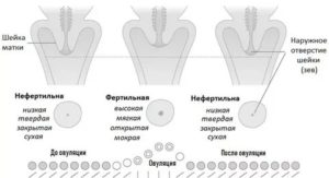 Мягкая матка что это?
