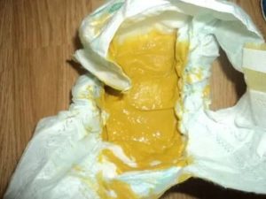 Плохо ест, срыгивания, пукает с калом, постоянно плачет, плохо спит