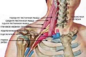 Боль под ключицей, ломит руку и шею слева