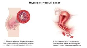 Физическая активность после выкидыша