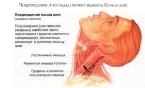 Тянет в горле и груди справа