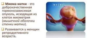 Боль при половом акте во время беременности